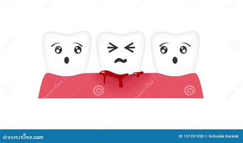 Gingivitis Tooth Blood Bleeding Vector Stock Vector Illustration Of