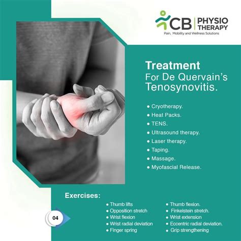 Physiotherapy Treatment For De Quervains Tenosynovitis Artofit