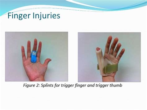 Finger Injury Treatment