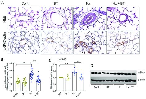 Butyrate Attenuates Hypoxia Induced Pulmonary Vascular Remodeling A