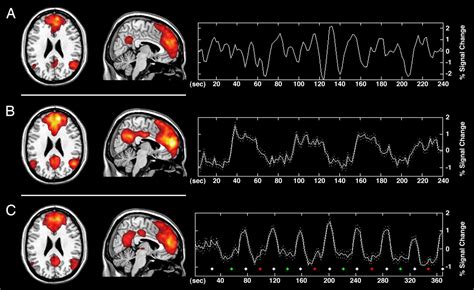 Consistency And Functional Specialization In The Default Mode Brain Network Pnas