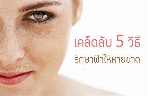 เคล็ดลับ 5 วิธีรักษาฝ้าอย่างไรให้หายขาด Punsuay