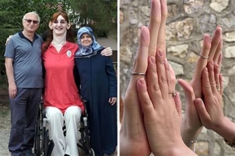 Rumeysa Gelgi The Worlds Tallest Woman Sets Three New Guinness World Records News18