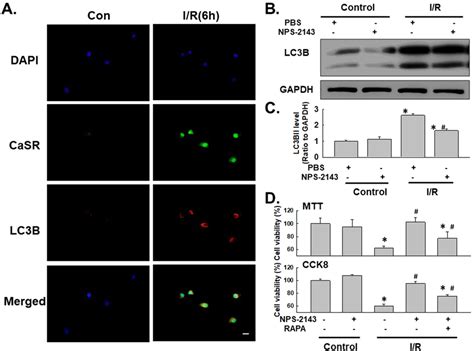 Autophagy Mediated The Effect Of Casr On I R Induced Cell Apoptosis