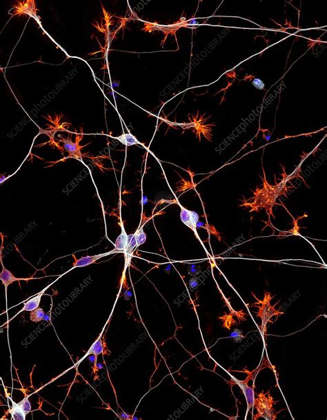 Neuron Fluorescence Microscopy