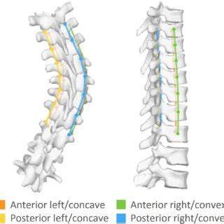 Optimization Correction Strength Using Contra Bending