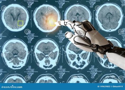 Smart Medical Concept Artificial Intelligence Use For Detect Cancer Or