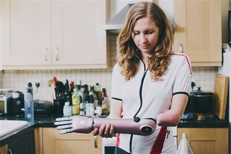 How does a bionic arm work? Find out more about our Hero Arm