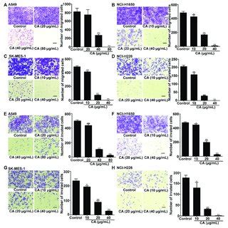 Cinnamaldehyde Ca Inhibits The Invasion And Migration Of Nsclc