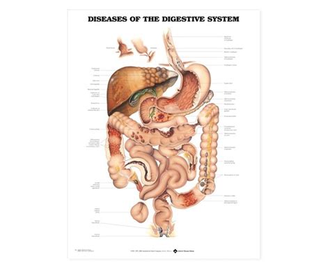 Digestive System Diagram Labeled Diseases