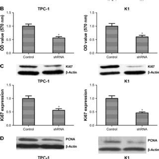 Knocking Down Nucb In Papillary Thyroid Cancer Cells Inhibited Tumor