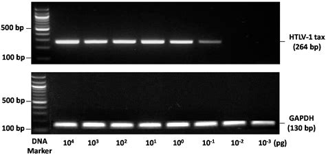 Viruses Free Full Text Analysis Of The Prevalence Of Htlv 1