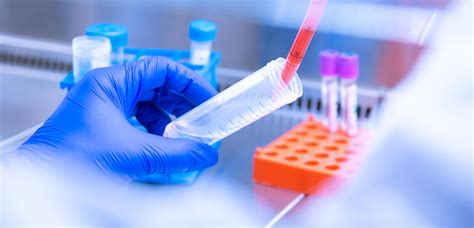 In Vitro Model Of Human Plasma Cell Differentiation Diag Tec