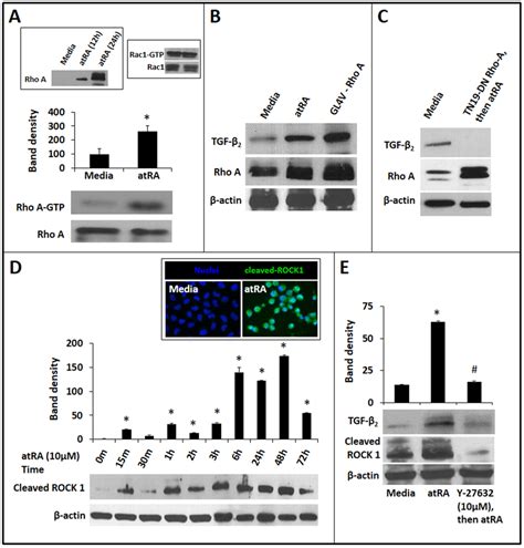 Atra Induced Tgf β2 Expression In Iecs Is Mediated Via Rhoa Gtpase And