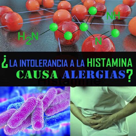 ¿la Intolerancia A La Histamina Causa Alergias La Guía De Las Vitaminas