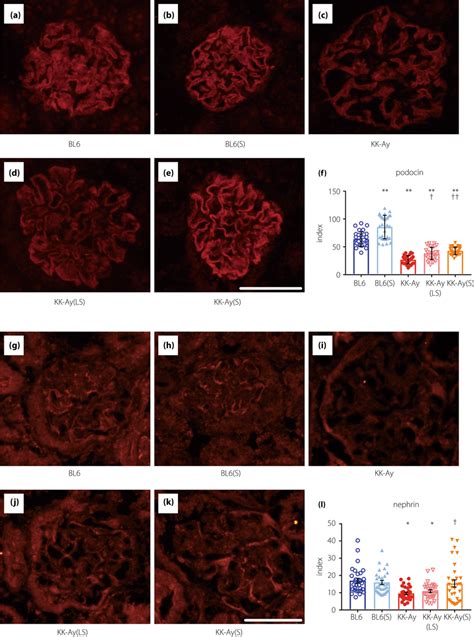 Effect of suramin on immunofluorescence staining for glomerular podocin... | Download Scientific ...