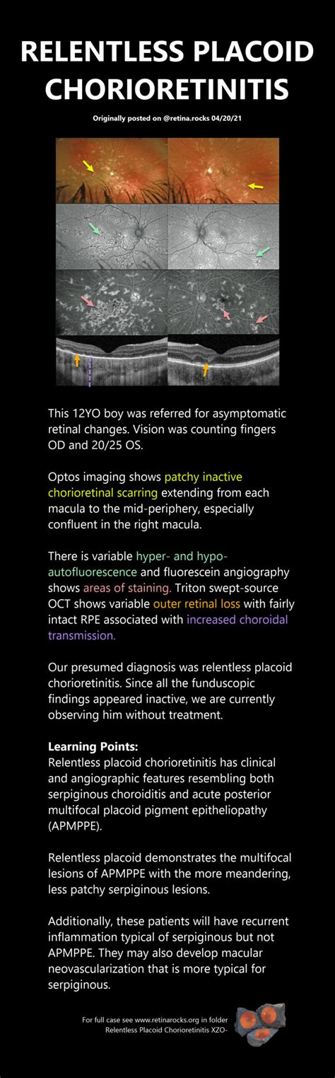 Inflammatory Disorders > Relentless Placoid (Ampiginous ...