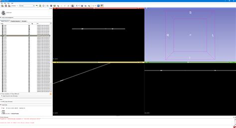 Merging Different Dicom Files Together Support 3d Slicer Community