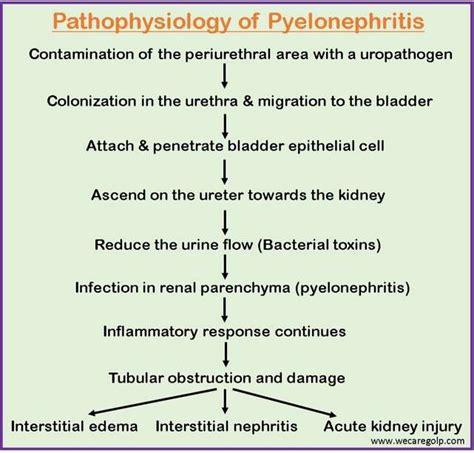 Pyelonephritis Classification Causes Management We Care