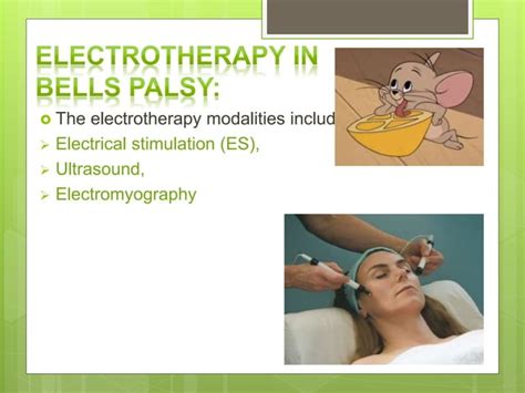 lower motor neuron lesion (LMNL) | PPT