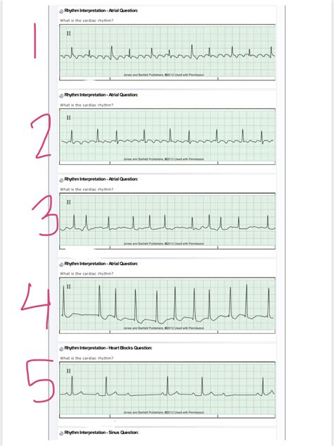 [solved] Hello I Need Help With These Ekg Questions Thanks D Course Hero