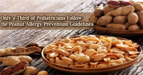 Only A Third Of Pediatricians Follow The Peanut Allergy Prevention