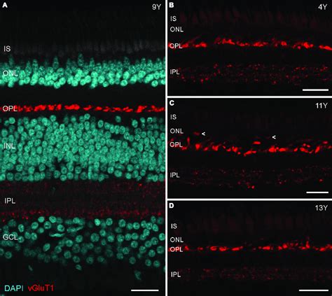 Vglut1 Expression In Aged Marmoset Retina A Vglut1 Staining In The