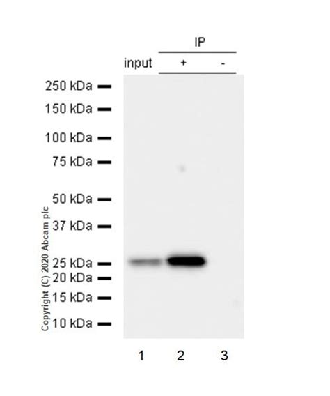 Recombinant Anti MRas Antibody EPR12457 KO Tested Ab176570 Abcam