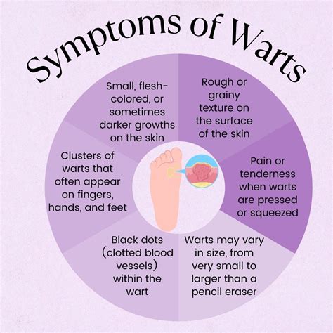 Warts: Causes, Risk Factors, Symptoms, Treatment