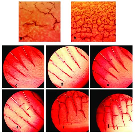 The Time Points Of The Fibrin Formation Process Under A Light