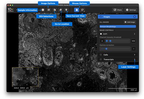 Xenium Explorer Navigation Official 10x Genomics Support