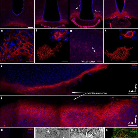 Wisteria Floribunda Agglutinin WFA Labeling In The Ventromedial ARC