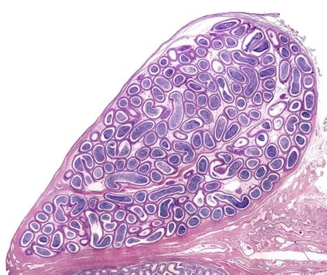 Chronic Epididymitis: Causes, Symptoms, Diagnosis, Treatment | STD.GOV Blog