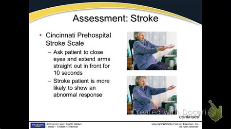 Stroke Emt Youtube