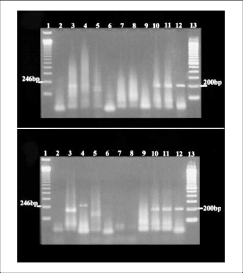 Rt Pcr Analysis Of Expression Of Bcr Abl Transcripts Total Cellular