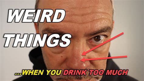 Alcoholic Nose The Secret To Quitting Drinking YouTube