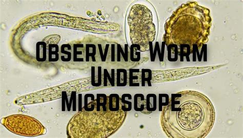 What Do Worms Look Like Under A Microscope