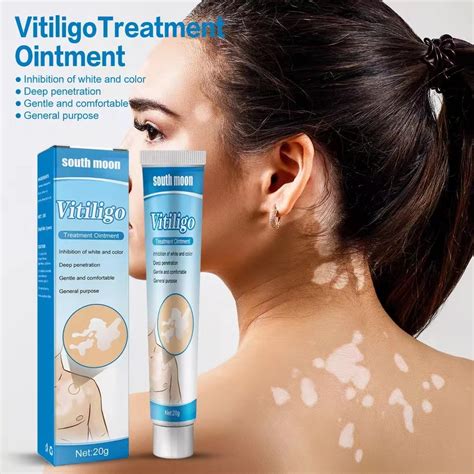 Atoderma Cream Vitiligo Treatment Cream Vitiligo Remover Vitiligo Cream