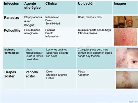 Infecci N De Piel Y Partes Blandas Ppt Descarga Gratuita