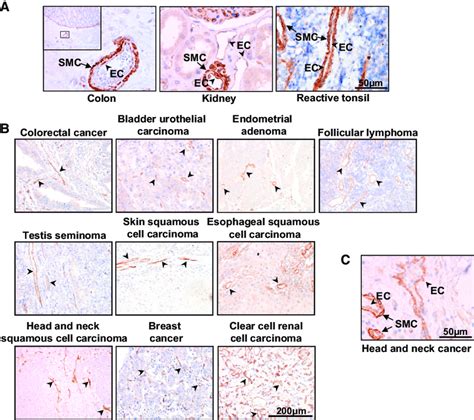 ELTD1 Vascular Expression in Primary Human Tissues (A) Pictures of ...