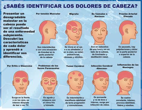 Honduras Nación y Mundo Cómo identificar el tipo de dolor de cabeza