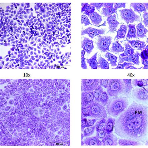 Morphology Of Hacat Cells A Non Uvb Induced B Uvb Induced Mj Cm