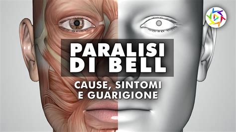 Paralisi Di Bell Cause Sintomi E Guarigione YouTube