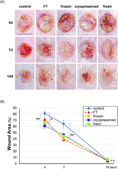 Wound area on days 4, 7, and 14 in the control, FT, frozen,... | Download Scientific Diagram