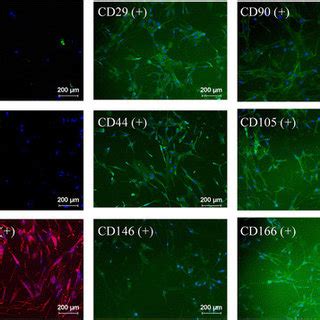 Surface markers. Illustrative micrographs of human mesenchymal stem ...