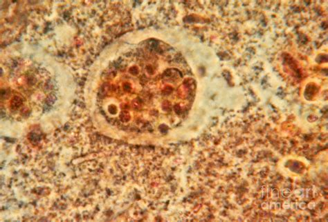 Entamoeba Histolytica Photograph By Eric V Grave