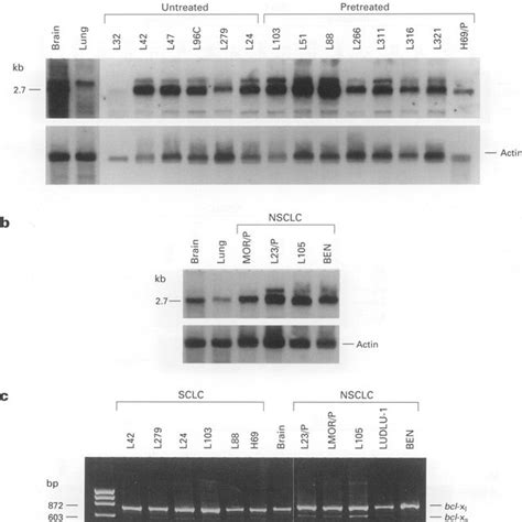 C Shows Bcl 2 Protein Expression In SCLC And NSCLC Cell Lines With