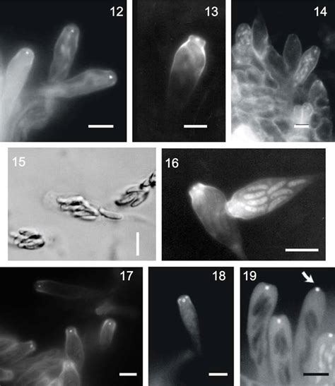 Examples of Type 2 and Type 3 asci: Type 2: 12. Eutypella alsophila... | Download Scientific Diagram