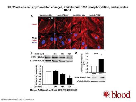 KLF2 Induced Actin Shear Fibers Control Both Alignment To Flow And JNK