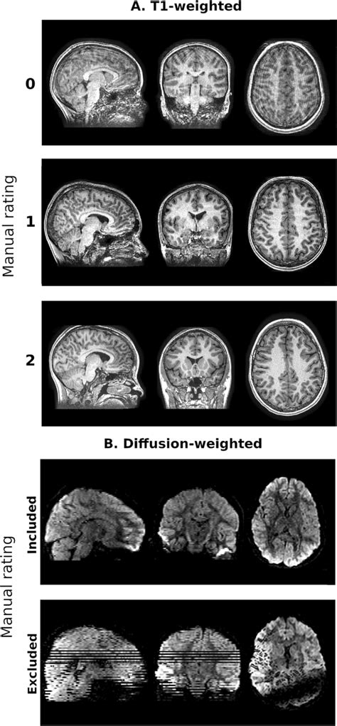 Examples Of A Quality Ratings For T1 And B Visible Motion